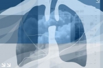女性肺癌比男性多一倍 专家：PM2.5和油烟都不是祸首 - Sh.Eastday.Com
