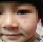 6岁女童小脸被“老师”扎6个洞 只因10 9没算好 - News.Online.Sh.Cn