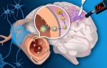 复旦大学研究发现肿瘤微环境响应探针
可用于脑胶质瘤手术导航 - 复旦大学