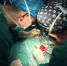 历经4小时手术 上海援疆医生为莎车女孩摘除巨大脑瘤 - 上海女性