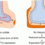 生命科学学院林鑫华团队
在肺早期发育的分子调控机制研究领域取得系列成果 - 复旦大学